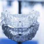 what is invisalign